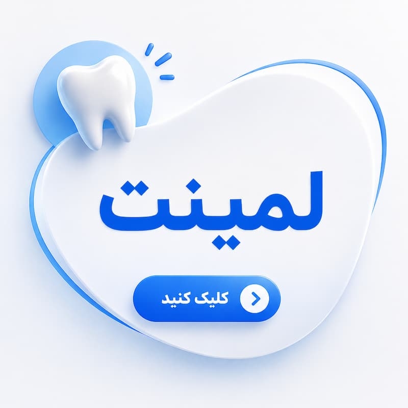 لمینت اقساطی